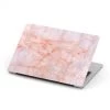 Harlow & Lloyd Macbook Hard Shell Case - Pink Granite Macbook Cases